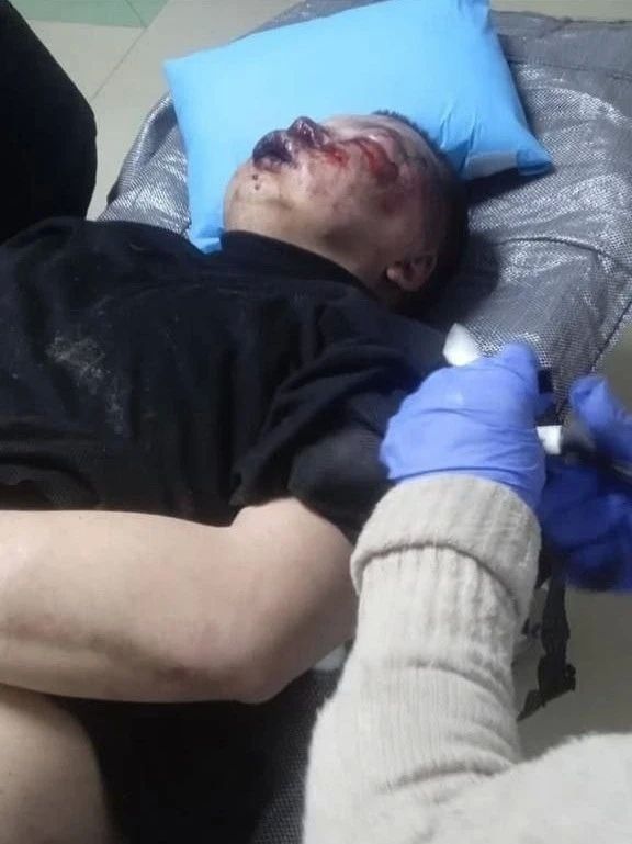 Группа пьяных хохлобоевиков похитила, избила до полусмерти и выбросила на окраине города 20-летнего парня за отказ продавать алкоголь